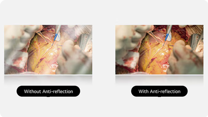 The left image shows a display without anti-reflection, with more glare and reflections affecting visibility. The right image, with anti-reflection coating, offers a clearer view with reduced glare.