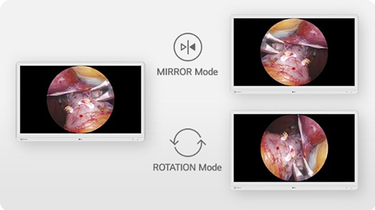 The video explains the mirror and rotation modes, allowing users to flip or rotate the display for optimal viewing during surgery. The video explains the mirror and rotation modes, allowing users to flip or rotate the display for optimal viewing during surgery.