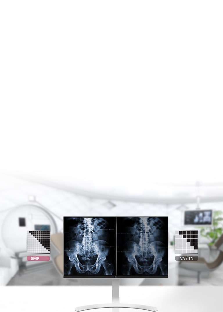 Alta Qualidade de imagem para a Sala de Operação1