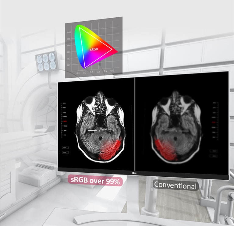 Cores fiéis e amplo campo de visão1