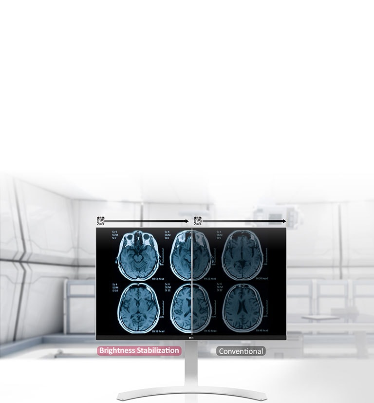 Estabilização de brilho1