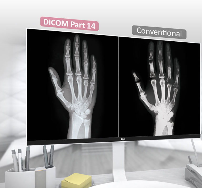 Compatível com a DICOM Parte 14 1