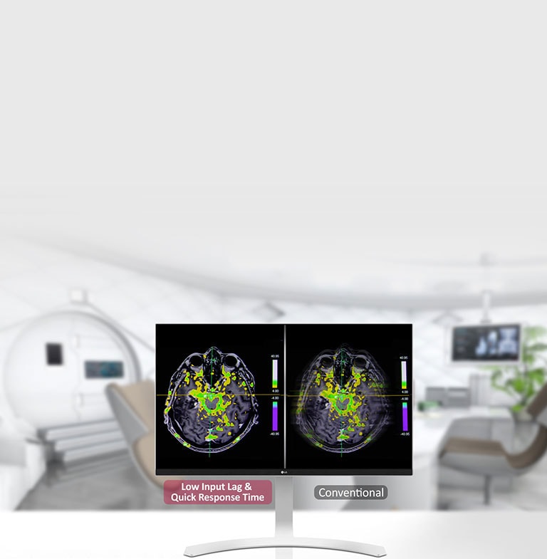 Curto tempo de resposta1