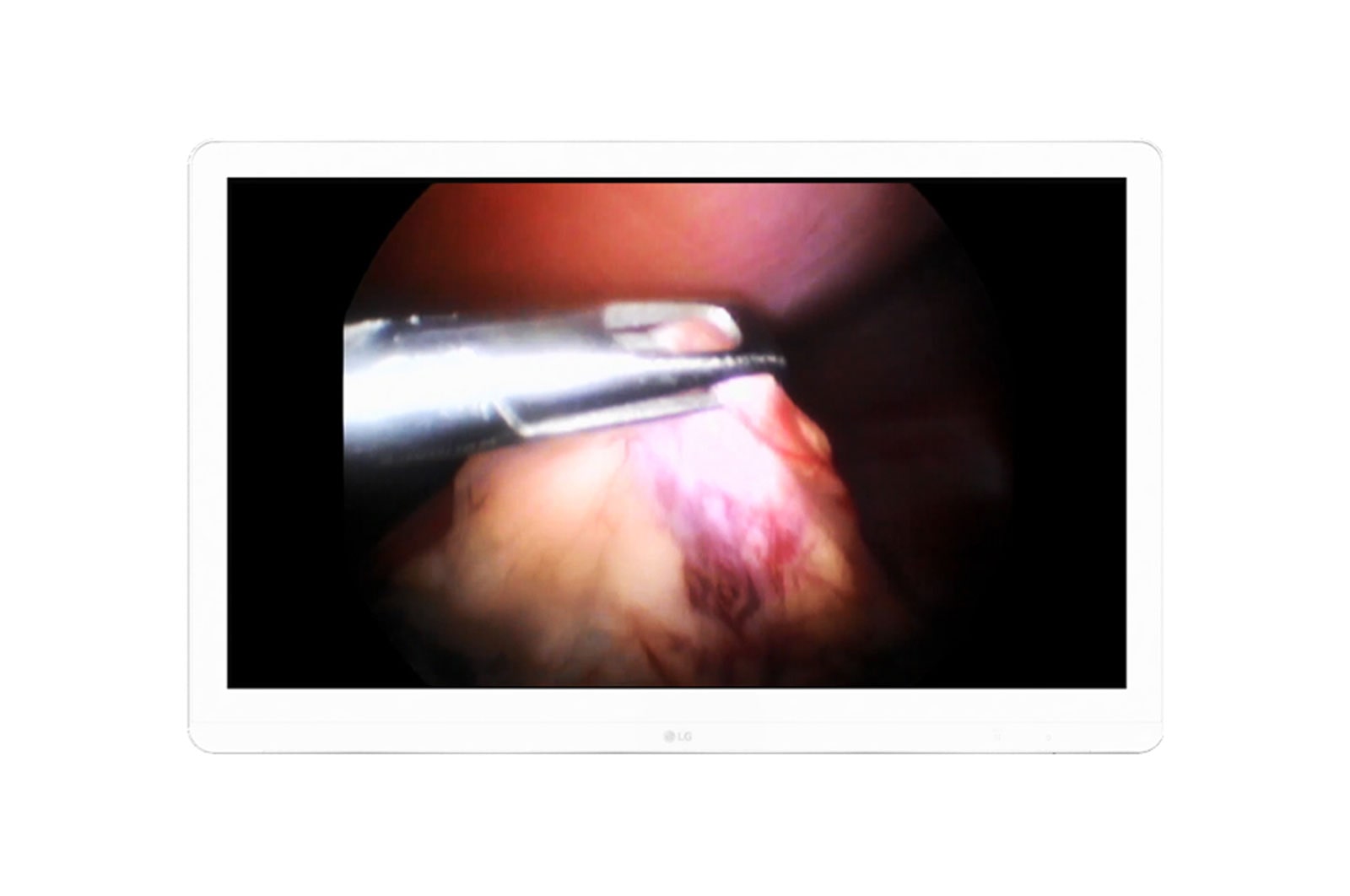 LG 27” Monitor Cirúrgico LG IPS 4K (8MP), 27HJ710S