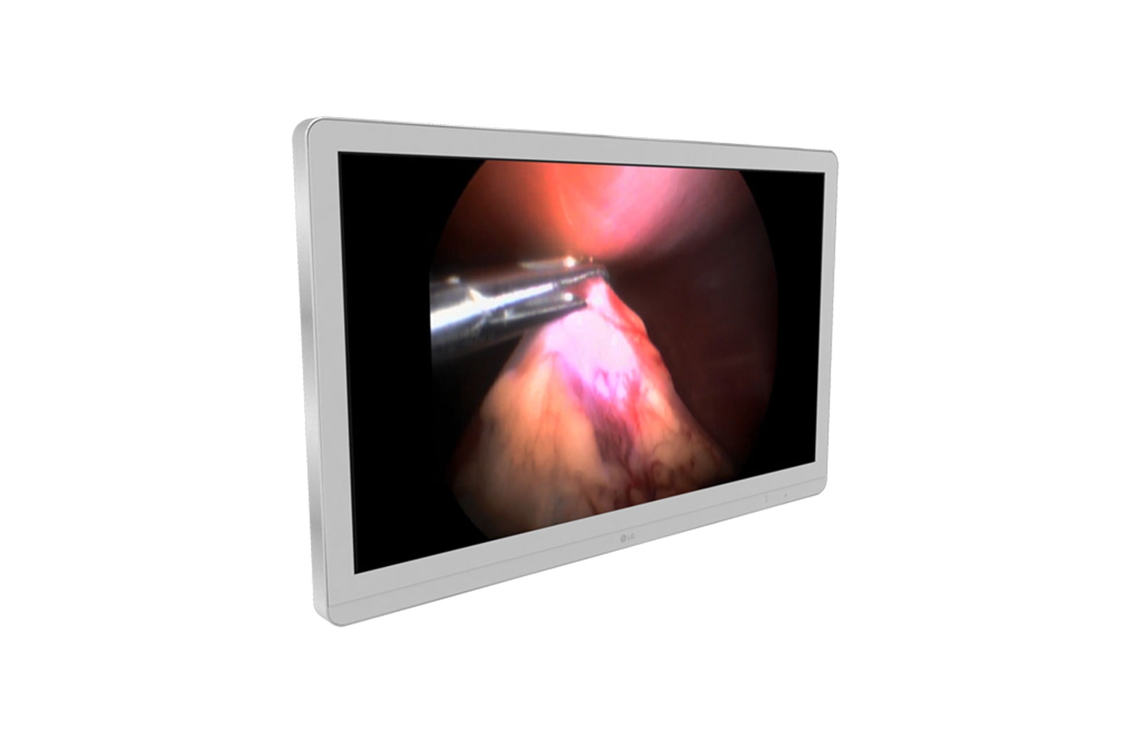 LG 27” Monitor Cirúrgico LG IPS 4K (8MP), 27HJ710S