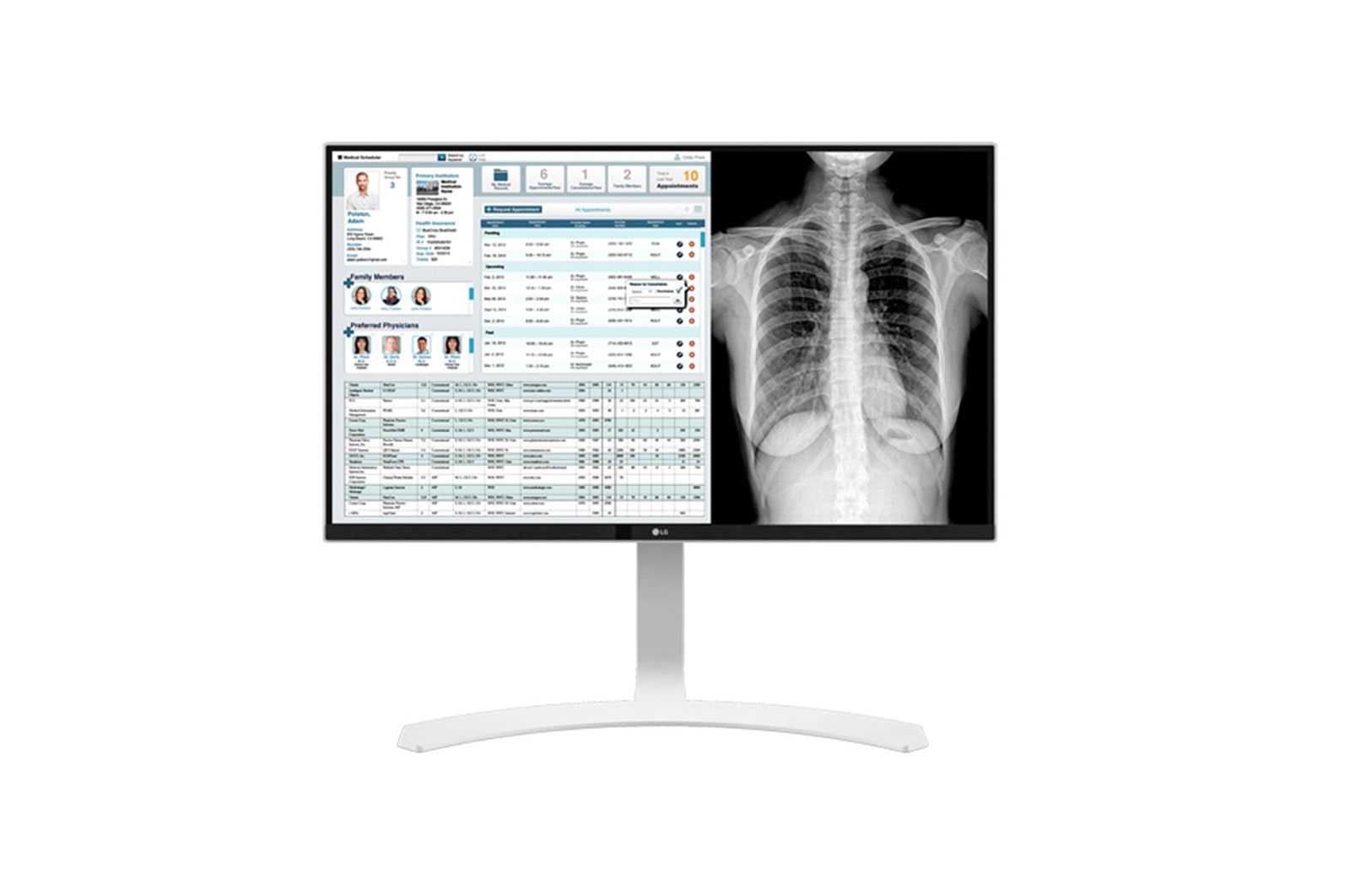 LG 27” Monitor Médico LG 8MP (4K) Branco, 27HJ712C