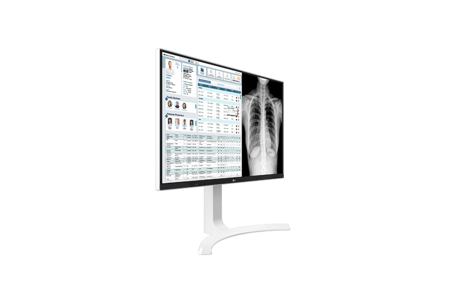 LG 27” Monitor Médico LG 8MP (4K) Branco, 27HJ712C
