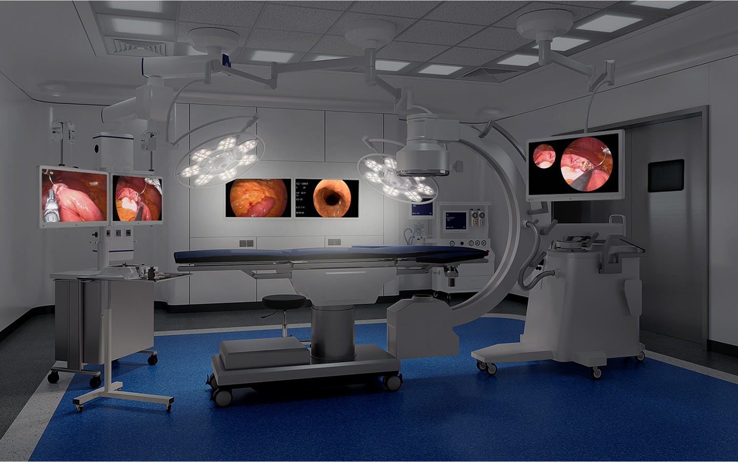 Uma sala de cirurgia moderna com luzes cirúrgicas, monitores médicos exibindo imagens endoscópicas e vários equipamentos ao redor da mesa.