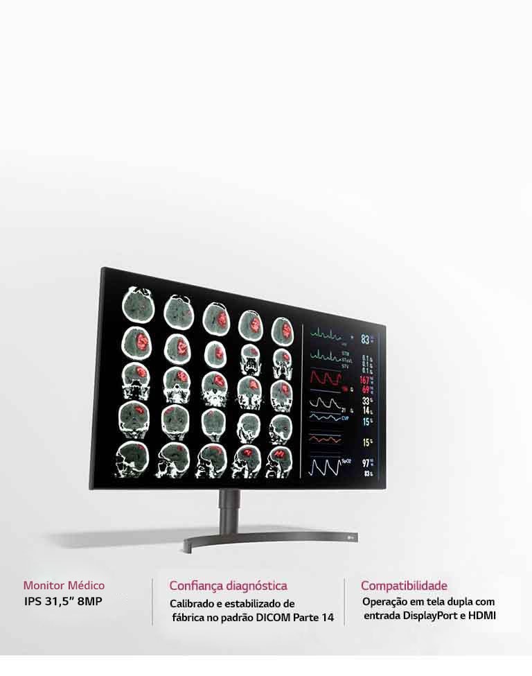 Monitor Médico 31,5'' e 8 MP
