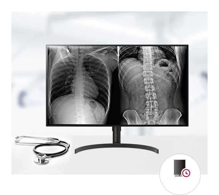 Qualidade de imagem constante