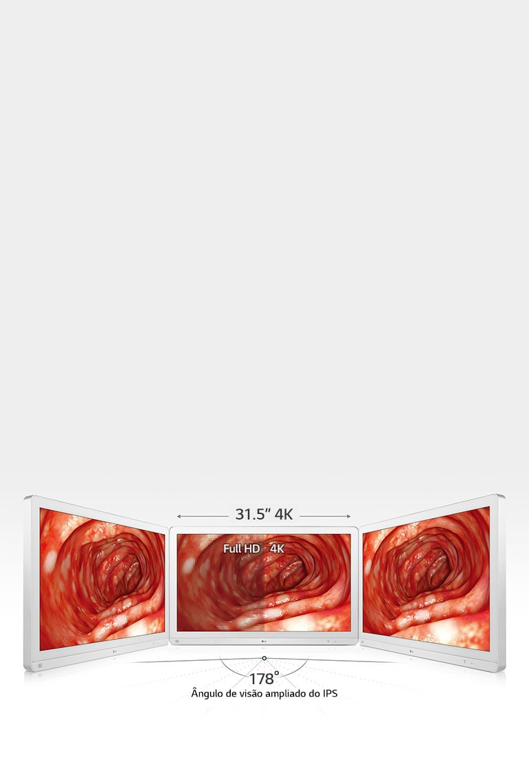 Maior precisão com ampla visualização