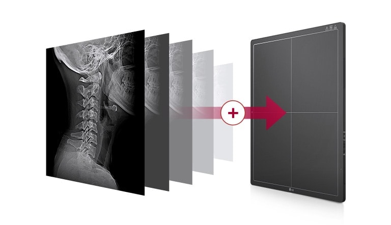 Um armazenamento de memória integrado que guarda automaticamente até 200 imagens tiradas no detector