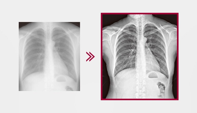 Resultado com melhor detalhamento pelo uso do Processamento de Imagem Multicamada integrado no AWS, em comparação com a imagem sem esse processamento