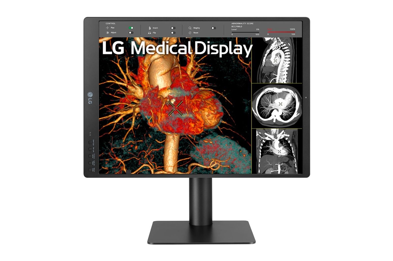 LG Monitor de diagnóstico LG IPS 21,3'' 3 MP, 21HQ513D-B