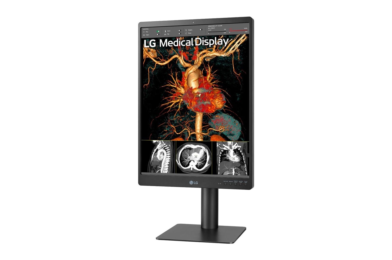 LG Monitor de diagnóstico LG IPS 21,3'' 3 MP, 21HQ513D-B