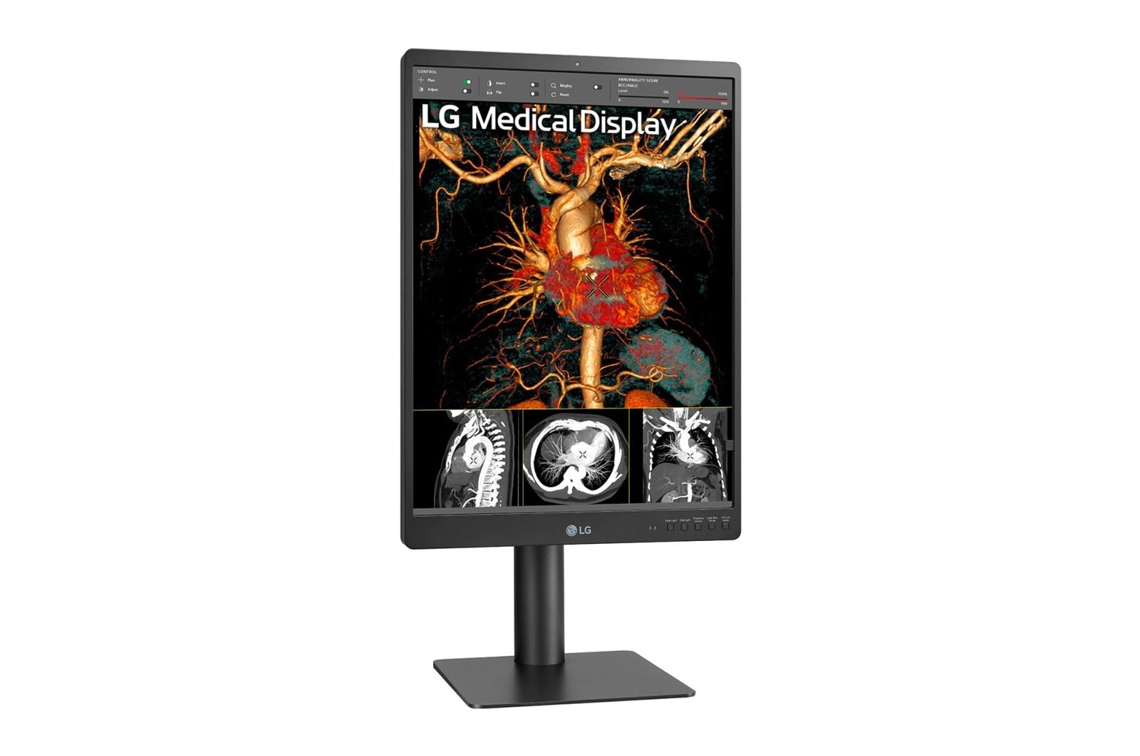 LG Monitor de diagnóstico LG IPS 21,3'' 3 MP, 21HQ513D-B