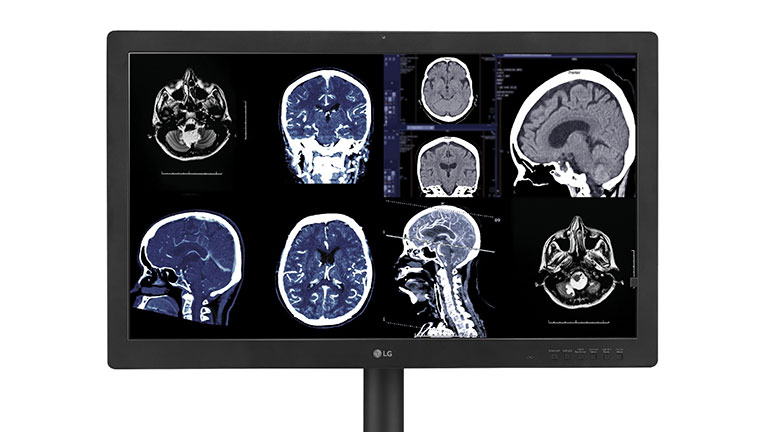 LG’s New Diagnostic Monitor With IPS Black Delivers Reliable Image Quality