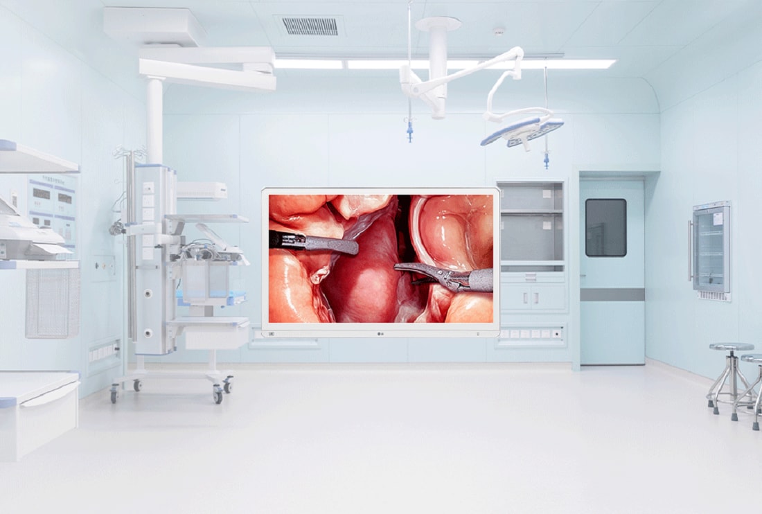 Modern surgical operating room equipped with advanced medical devices, featuring a large display screen showing a close-up of a minimally invasive surgery inside the human body.