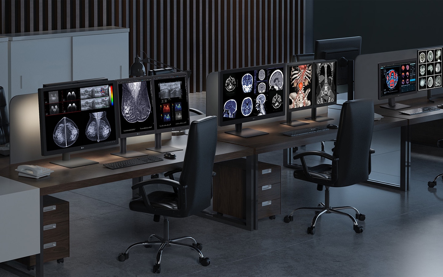 Monitores médicos de LG que muestran resonancias magnéticas de mama y cerebro de alta resolución en una sala de diagnóstico hospitalaria. Optimizado para la precisión diagnóstica y los flujos de trabajo en radiología.