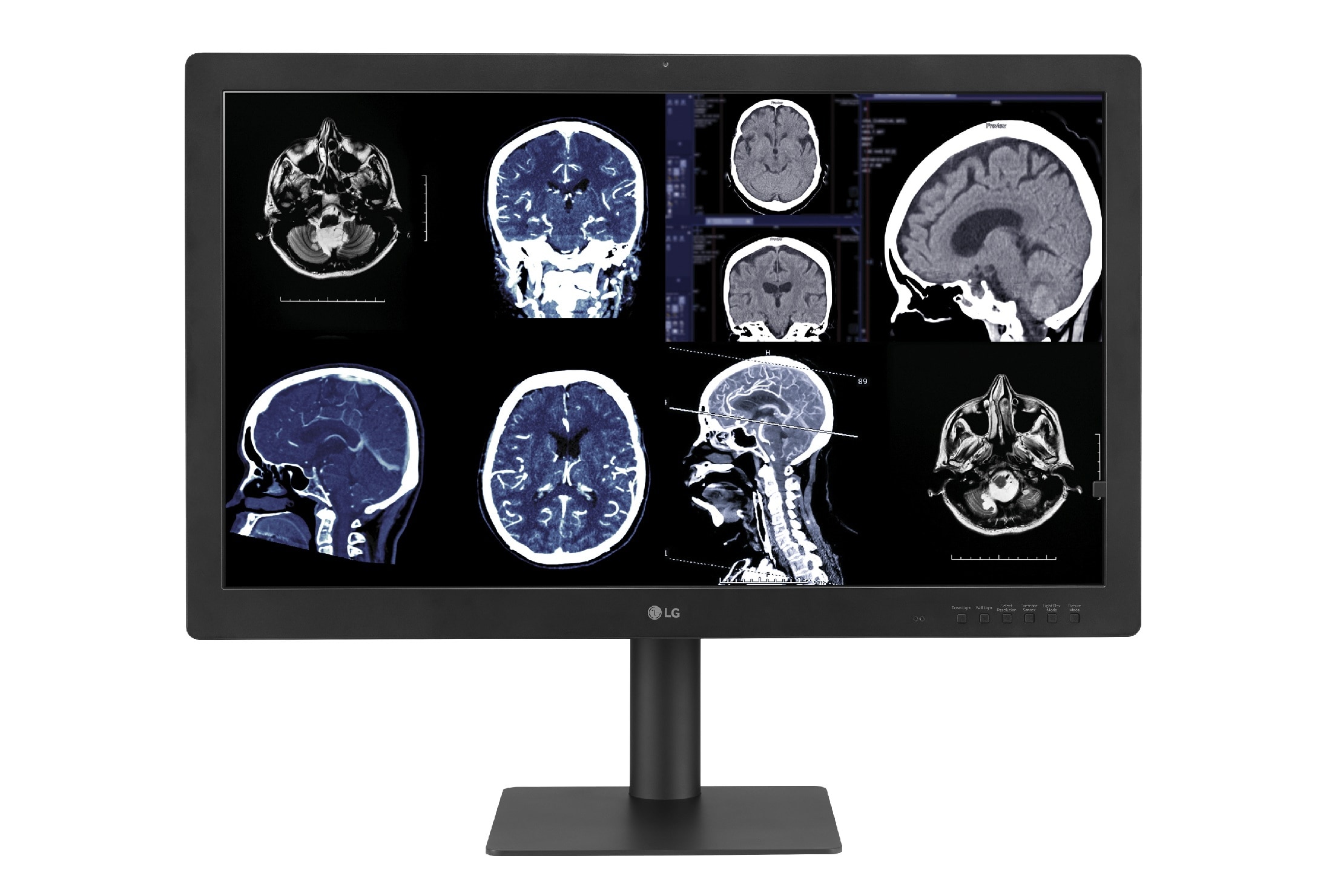 El nuevo monitor de diagnóstico de LG con IPS Black ofrece una calidad de imagen confiable