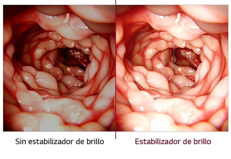 Estabilización de brillo