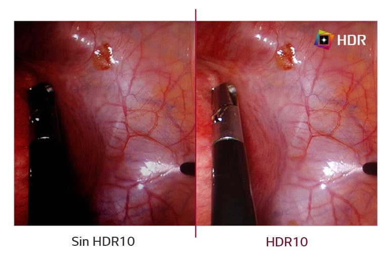 Soporte HDR10
