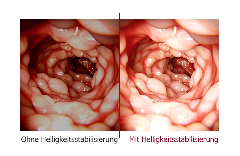 Helligkeitsstabilisierung1