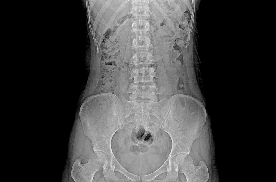 Hochauflösende und klare diagnostische Bildgebung durch den Einsatz von LG DXD. Hochauflösende und klare diagnostische Bildgebung durch den Einsatz von LG DXD.