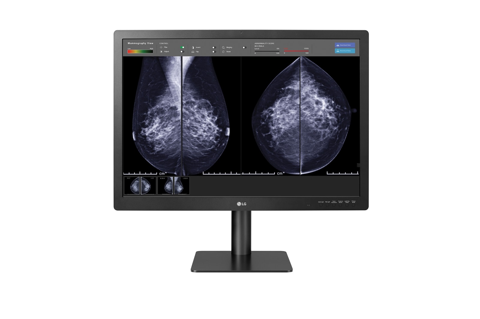 LG 31 Zoll 12 MP Mammographie Diagnosemonitor mit IPS, 31HN713D-BA
