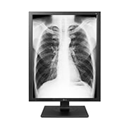 LG 21,3 Zoll 3MP Diagnosemonitor mit DICOM-Kennlinie, 21HK512D-B