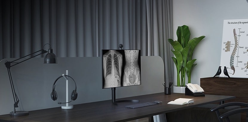 Configuration de bureau avec moniteurs d’imagerie médicale affichant des radiographies, symbolisant les LG Medical Display pour les professionnels de santé.