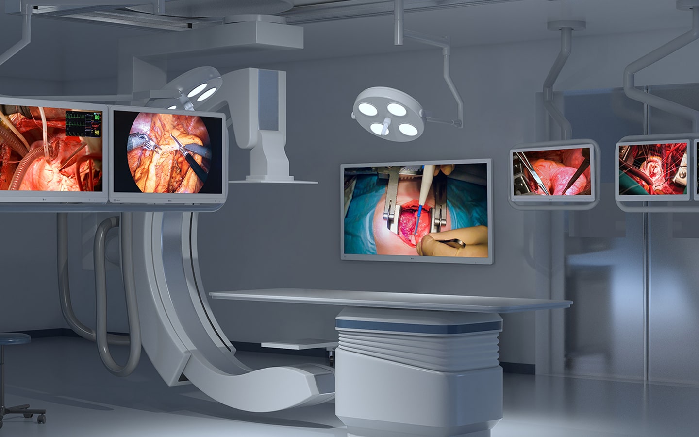Moniteurs médicaux LG installés dans une salle d’opération moderne, montrant plusieurs flux de chirurgie en direct. Visualisation fiable pour les équipes chirurgicales.