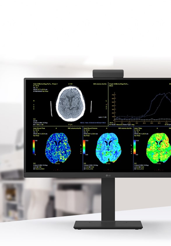 Gros plan du moniteur clinique LG montrant des examens d’imagerie cérébrale multicolores pour une évaluation neurologique.