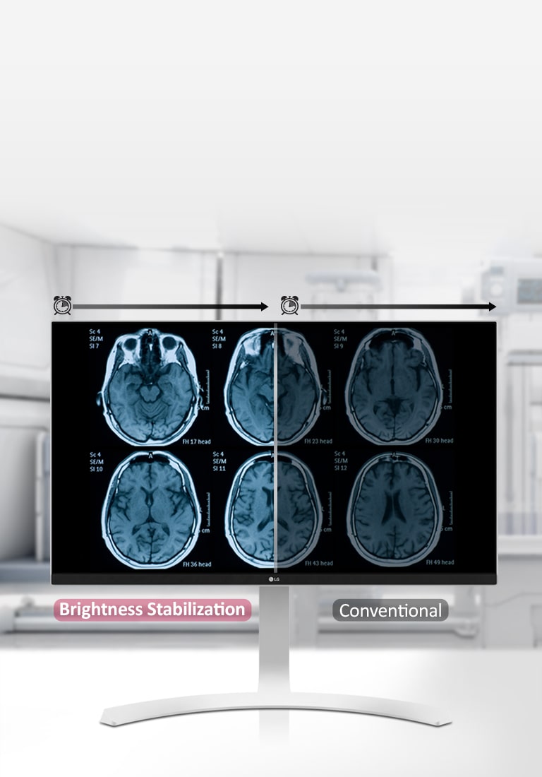 Brightness Stabilization2