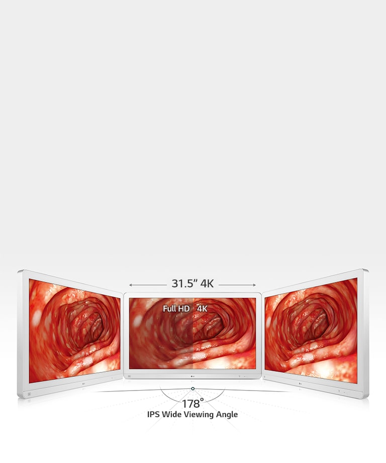 Enhanced Accuracy with Wide View2