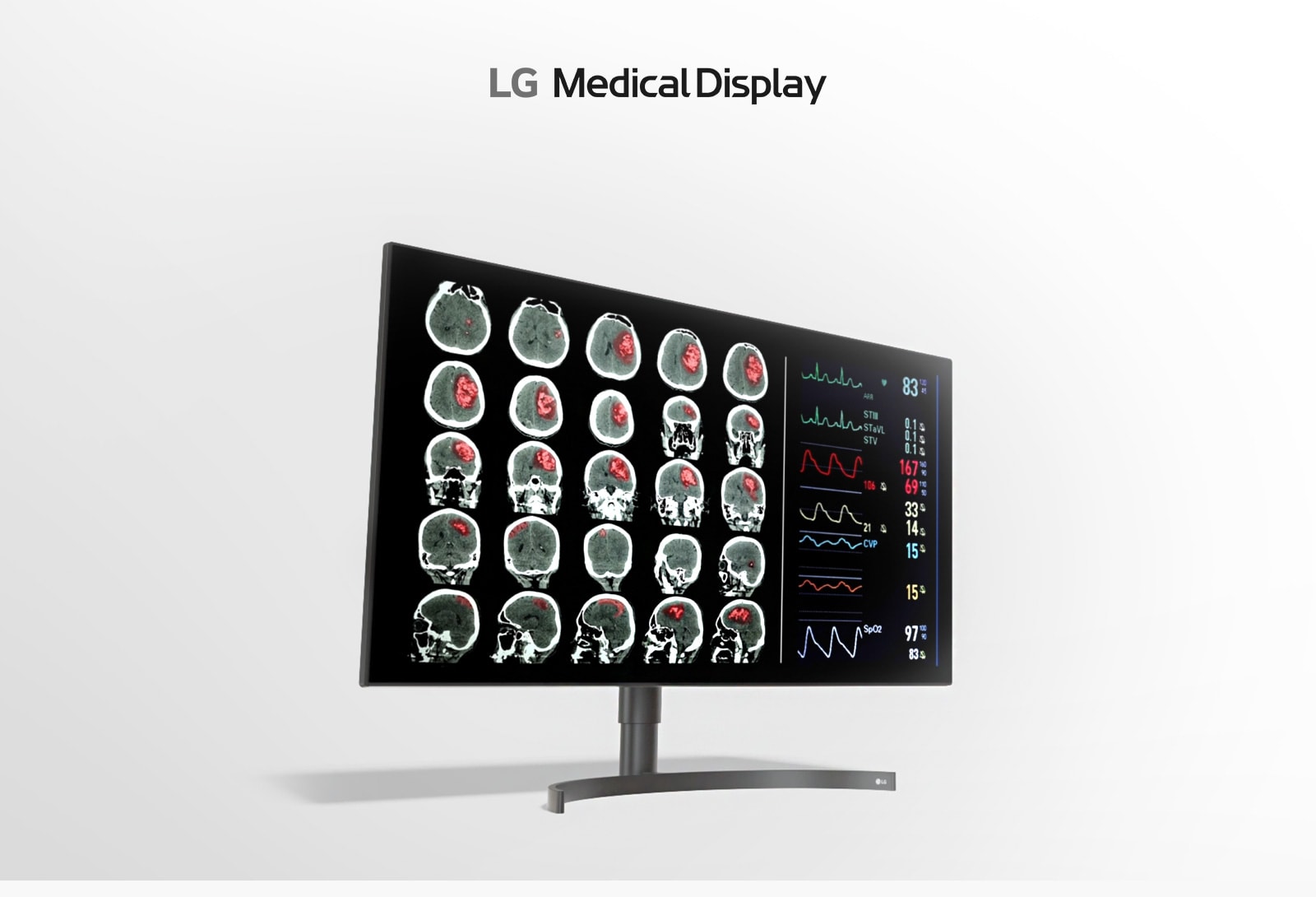 LG 32HL512D 32″ IPS clinical reporting and home reporting monitor, front product view