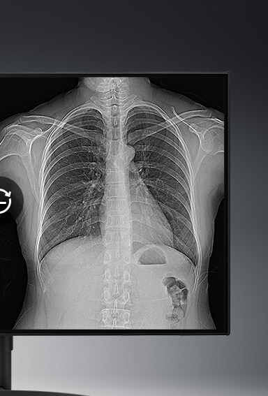 Brightness Stabilization monitor display