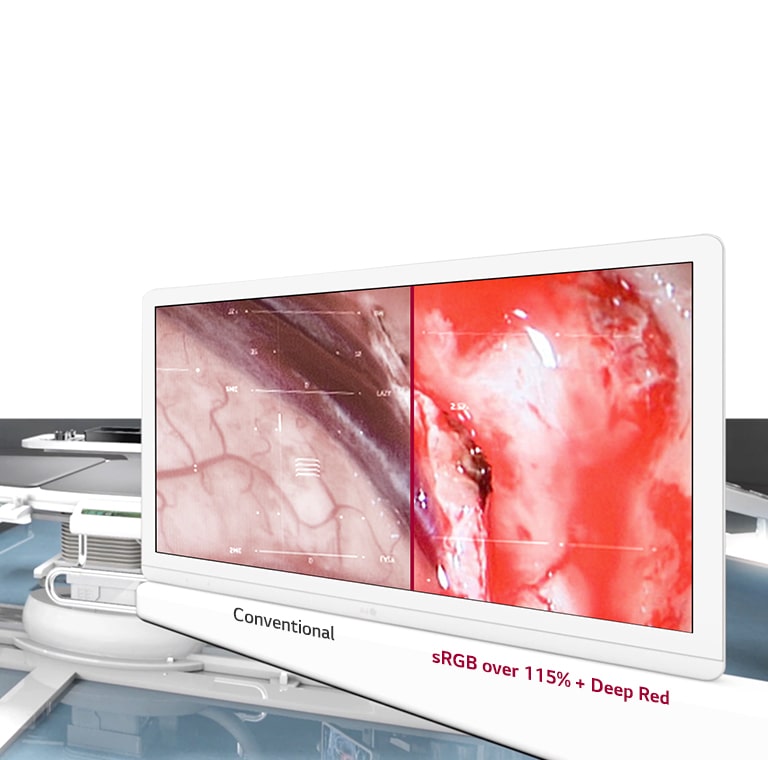 Optimal Image Quality1