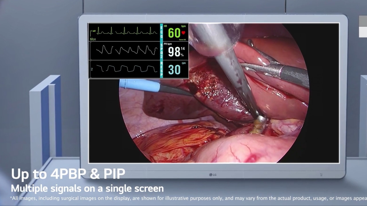 surgical-monitor-27hs714s-2025-feature-00-fullmovie