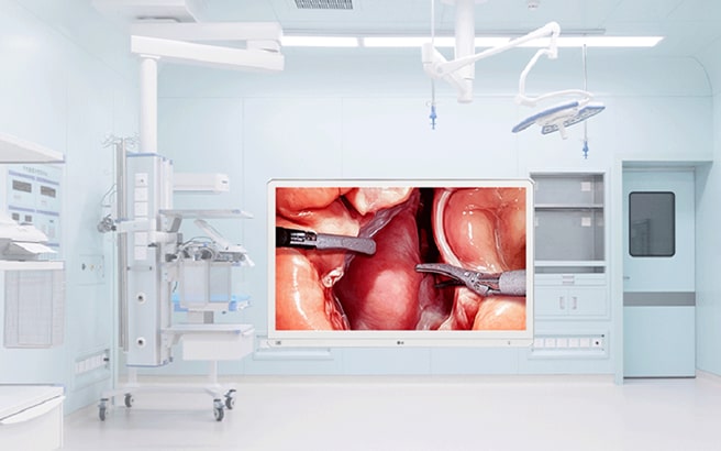LG Launches 4K Surgical Monitor With Intelligent Features To Optimize Surgical Workflow