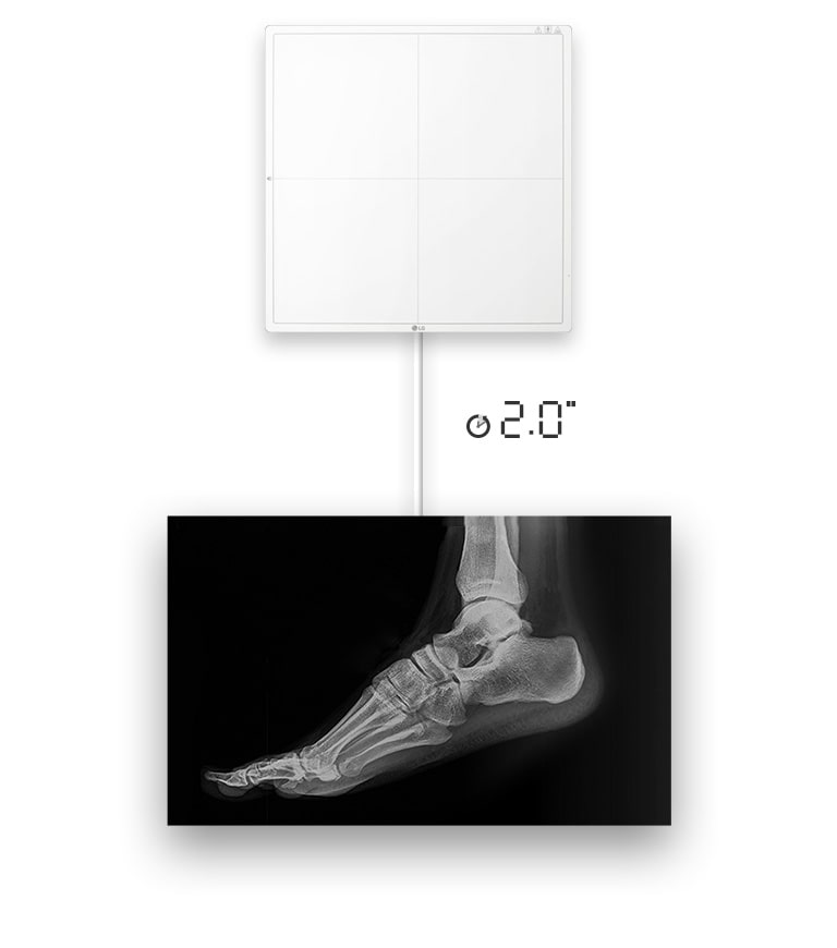 Image availability in 2 seconds with a wired connection.