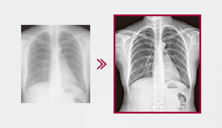 The more finely detailed image result using Multi-layer Image Processing embedded in the AWS, comparing to the image result without Multi-layer Image Processing