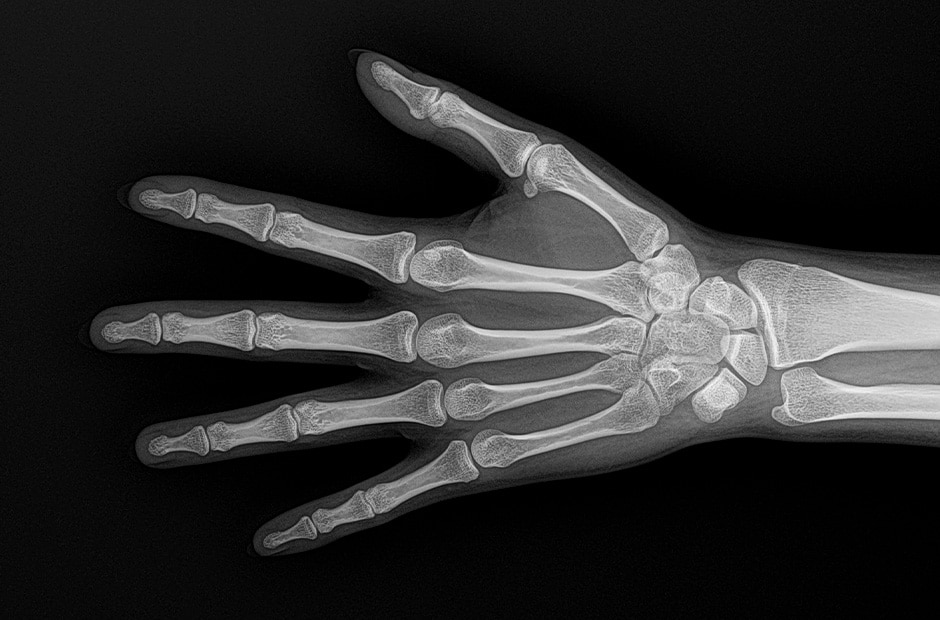 x-ray image 3.