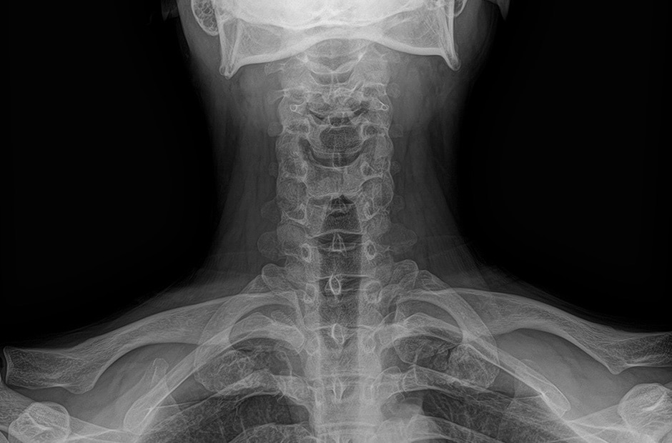 x-ray image 3. x-ray image 3.