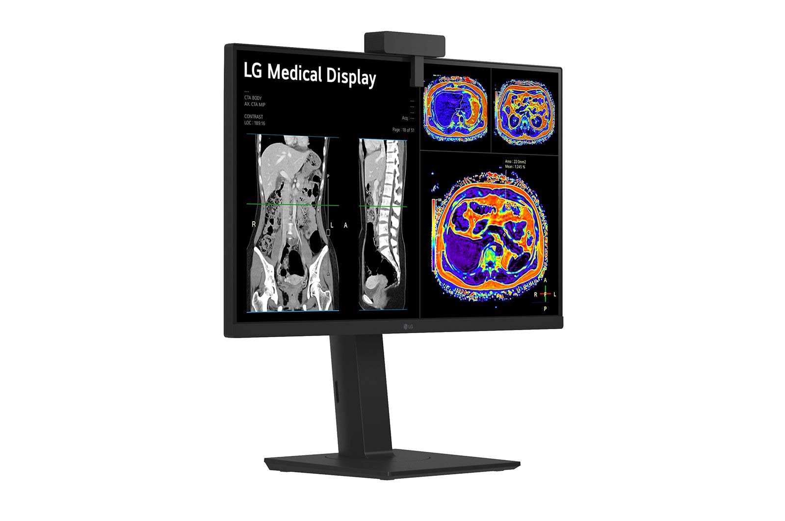 LG 27” 8MP IPS Clinical Review Monitor, 27HS713C