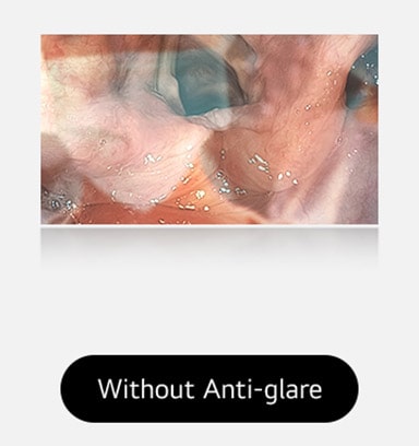 The left image shows a display without anti-glare, where reflections and glare obscure the view.	