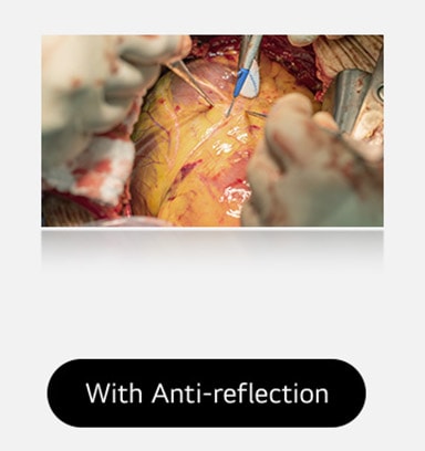 The right image, with anti-reflection coating, offers a clearer view with reduced glare.	