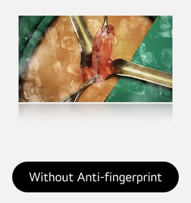 The left image shows a display with visible fingerprints and smudges, obstructing the view. 