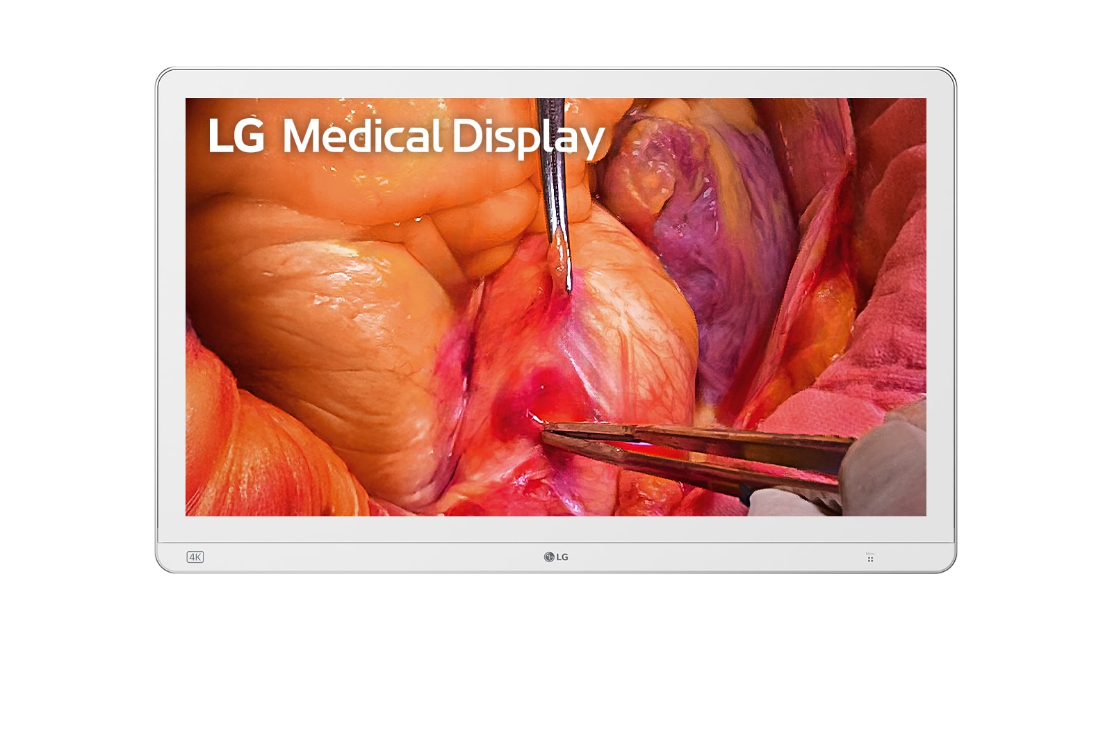 LG 27-inch 4K Mini-LED surgical monitor, 27HS714S