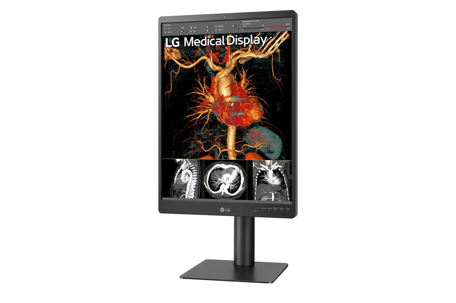 LG 21.3'' 3MP IPS Diagnostic Monitor, 21HQ513D